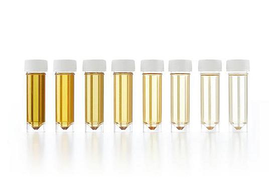 What could be causing my dark, smelly urine? featured image