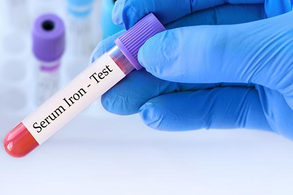 Close-up of a gloved hand holding a vial of blood for testing, with the label serum iron test.