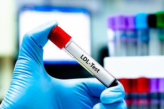 Could my LDL cholesterol level be too low? featured image