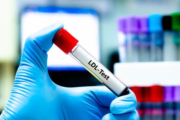 Could my LDL cholesterol level be too low?