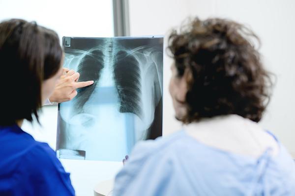 Is a lung nodule the same as lung cancer?