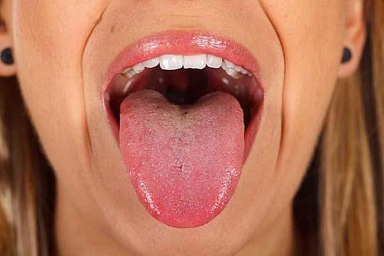 What causes a sensitive tongue? featured image