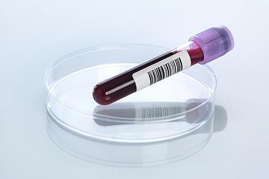 What might be causing my anemia? featured image