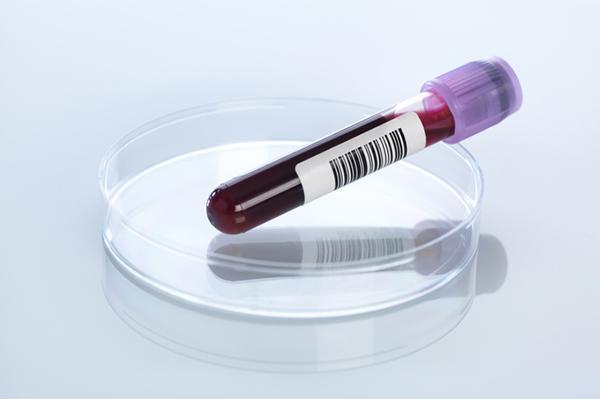 A tube containing blood for testing resting in a petri dish.