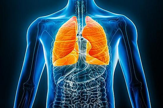 What is pleurisy? featured image