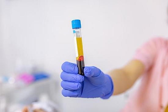 What could cause a high lymphocyte count? featured image