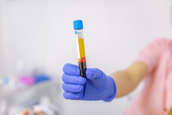 A gloved hand holds a tube of blood for testing.