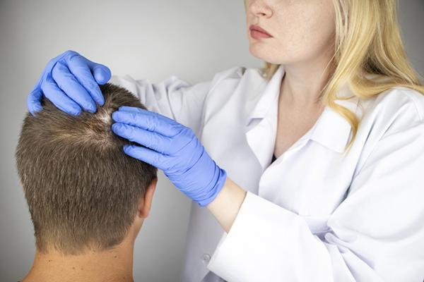 What can cause hair loss in small patches?