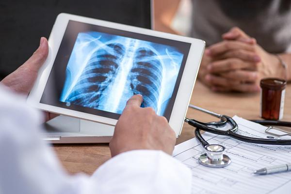 What are pulmonary calcifications?