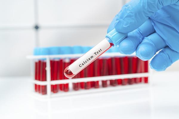 A gloved hand holds a tube of blood for testing, labeled calcium test.
