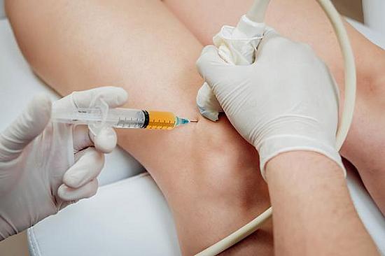PRP injection for knee osteoarthritis: Does it work? featured image