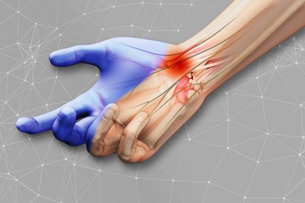 What's the best treatment for carpal tunnel syndrome?