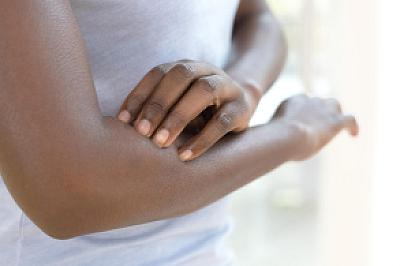 Quiz: How much do you know about skin conditions featured image
