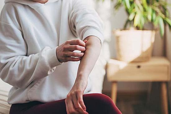 Antihistamines may not offer meaningful relief from eczema symptoms featured image