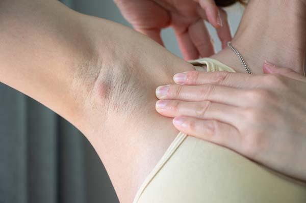 What causes recurring underarm boils, and how are they treated?