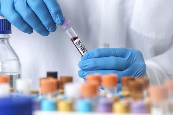 Is a thyroid-stimulating hormone level of 1.32 healthy?