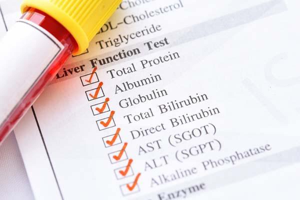What does a high bilirubin level in my blood test actually mean?