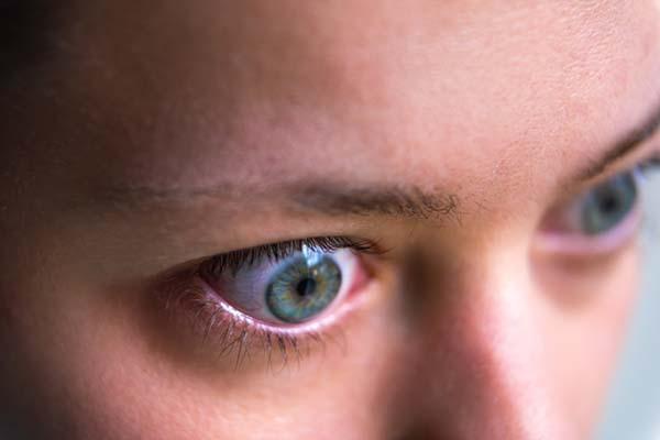 What can cause bulging eyes to develop?