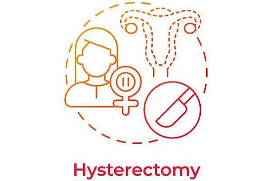Should you have a hysterectomy? featured image