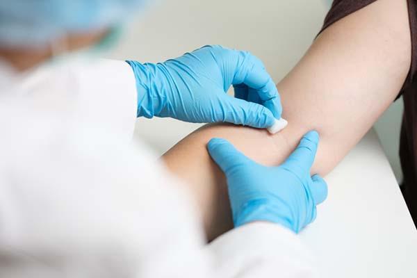 What does a positive TB skin test mean?