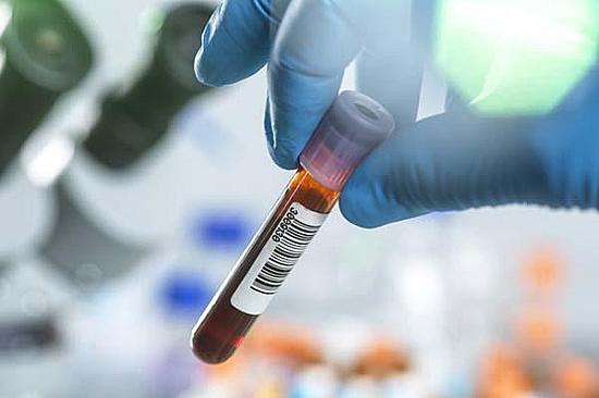 What can cause enlarged red blood cells? featured image