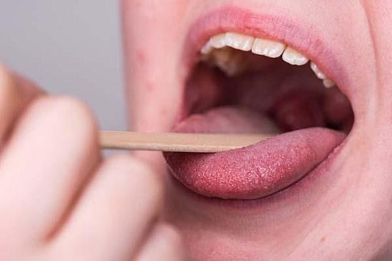 What could a persistent salty taste in the mouth mean? featured image