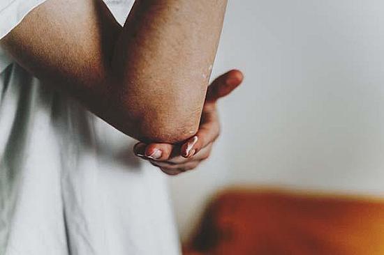 What everyday irritants can trigger eczema flare-ups? featured image