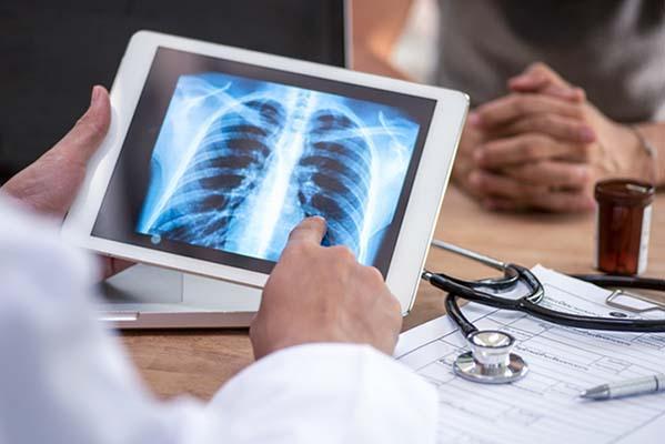 What tests may confirm sarcoidosis?