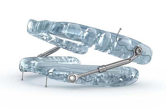 For sleep apnea, a dental device may be as effective as CPAP featured image