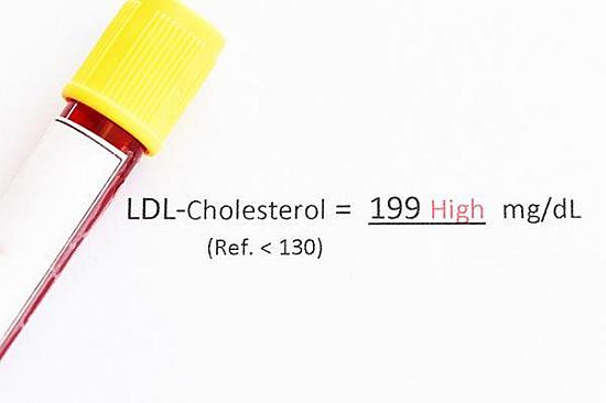 LDL cholesterol: Will it increase on a low-carb or keto diet? featured image
