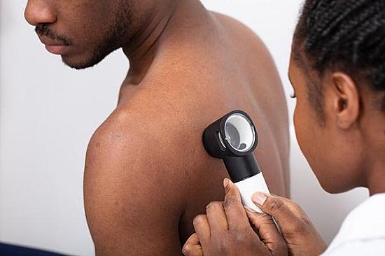 How does skin cancer differ in darker skin? featured image
