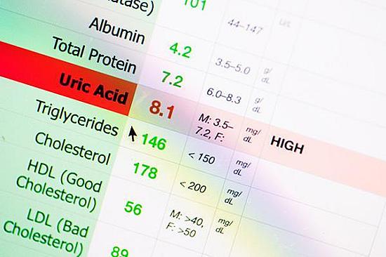 When is treatment needed for high uric acid? featured image
