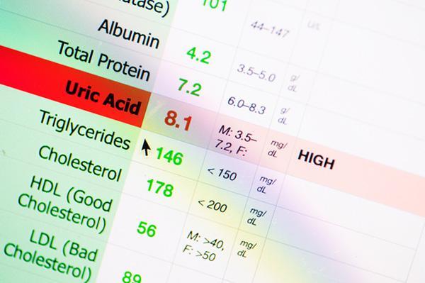 When is treatment needed for high uric acid?