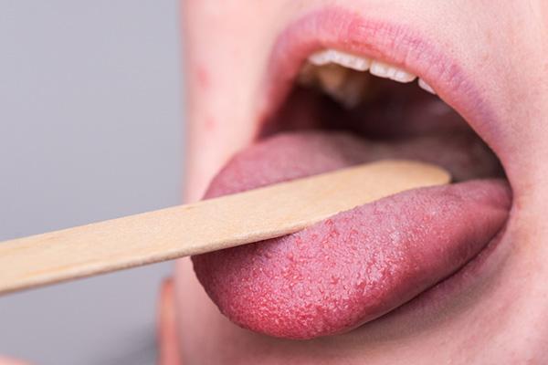 What can cause a red, tingling tongue?