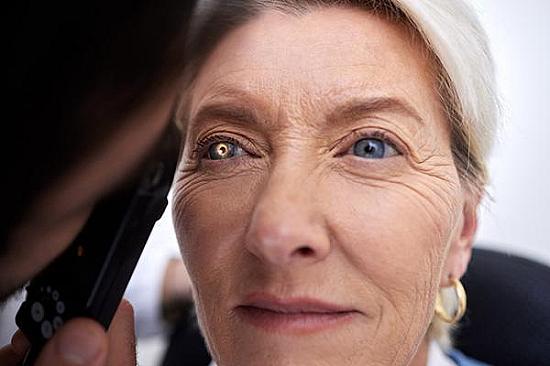How can entropion affect your eyes? featured image
