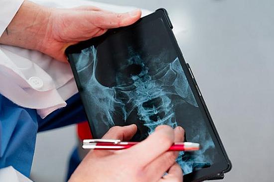 What causes a vertebra to slip backward? featured image