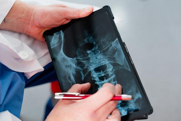 What causes a vertebra to slip backward?