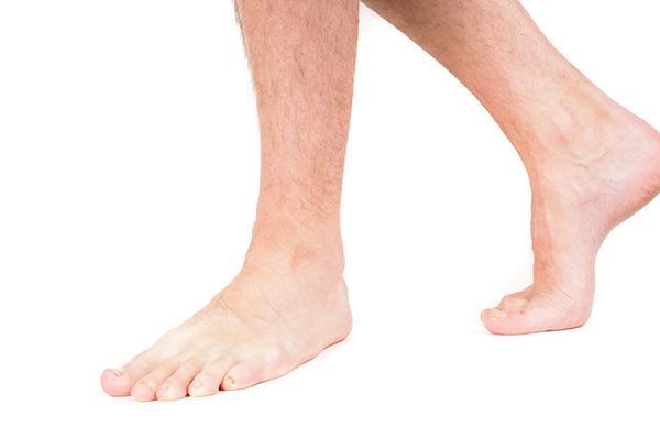 Hallux rigidus: How to treat big toe arthritis