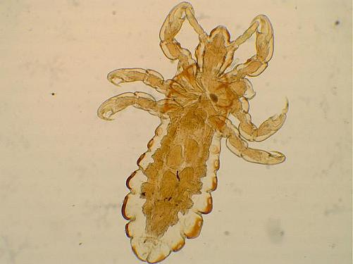 Head lice featured image