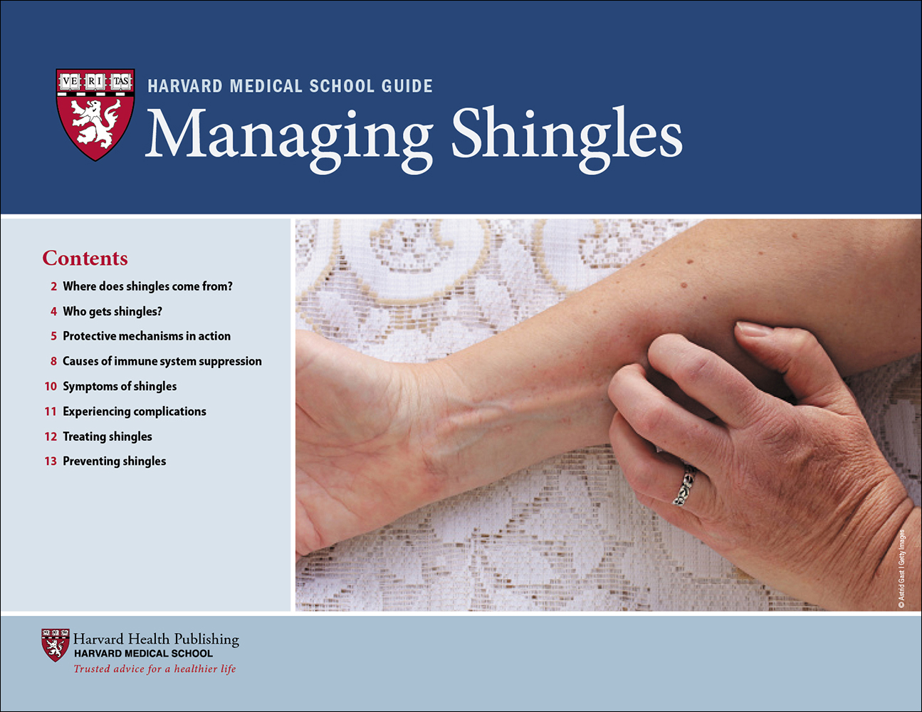 Identifying and Treating Shingles on Your Leg and Groin - Pensler Vein  Institute