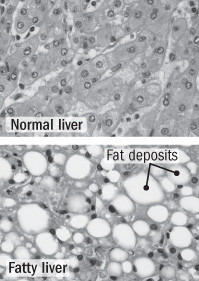 Abundance of fructose not good for the liver, heart