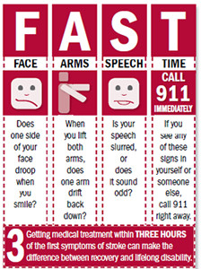 FAST - Identify a stroke FAST chart