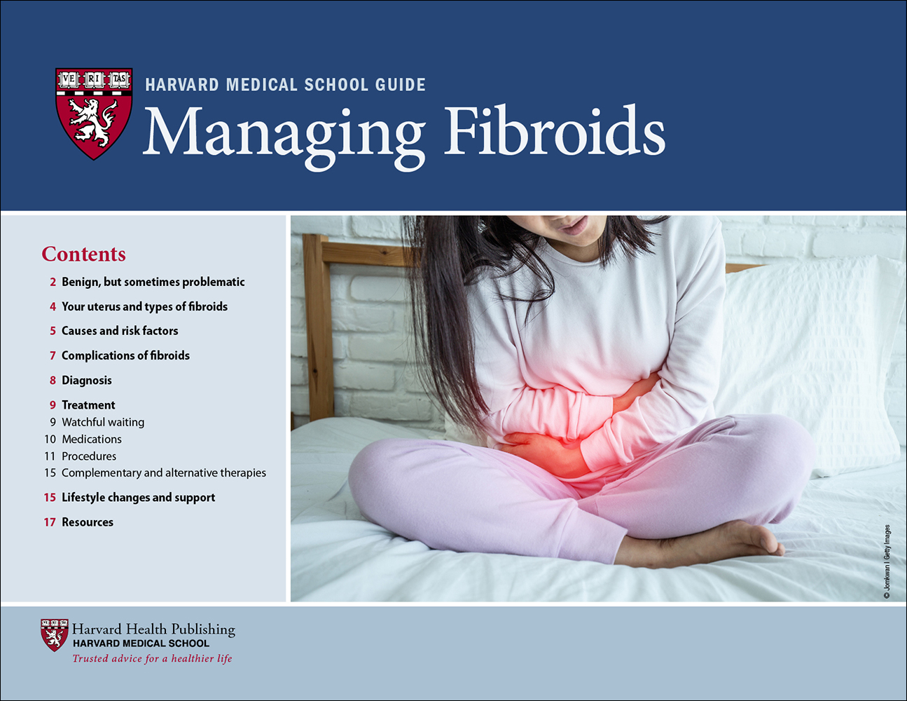 Managing Fibroids