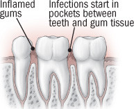 Brushing up on brushing