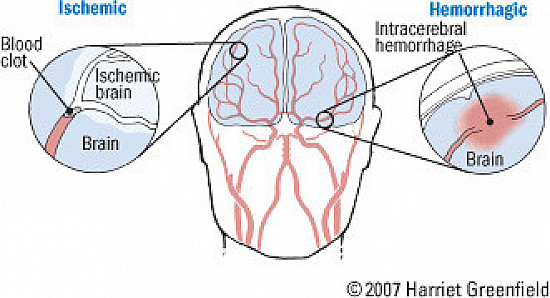 Cholesterol, the mind, and the brain featured image