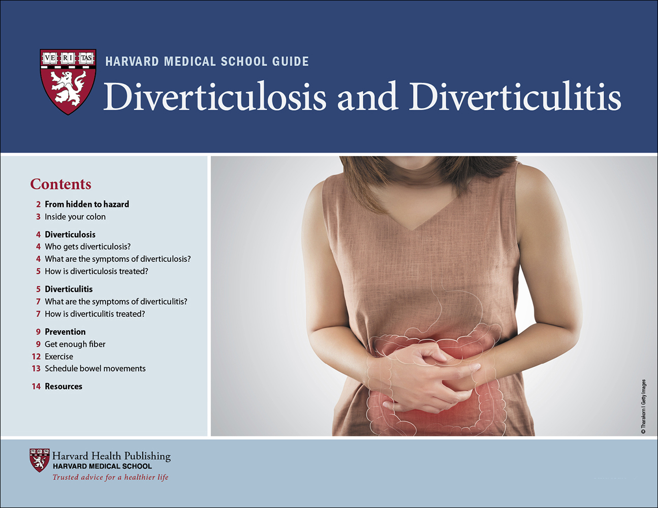 Diverticulosis and Diverticulitis Harvard Health