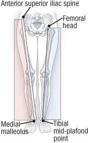 illustration of ways to measure leg length