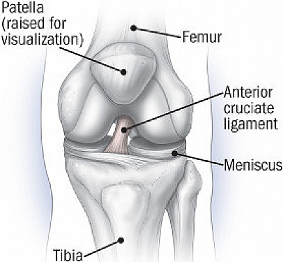 You've torn your ACL. Now what? featured image