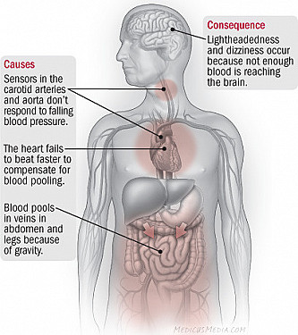 With rising, a fall in blood pressure featured image