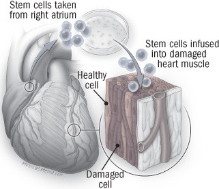 Small step forward for stem cells, giant leaps remain